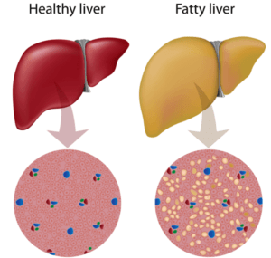 Protein Benefits for your Liver Health